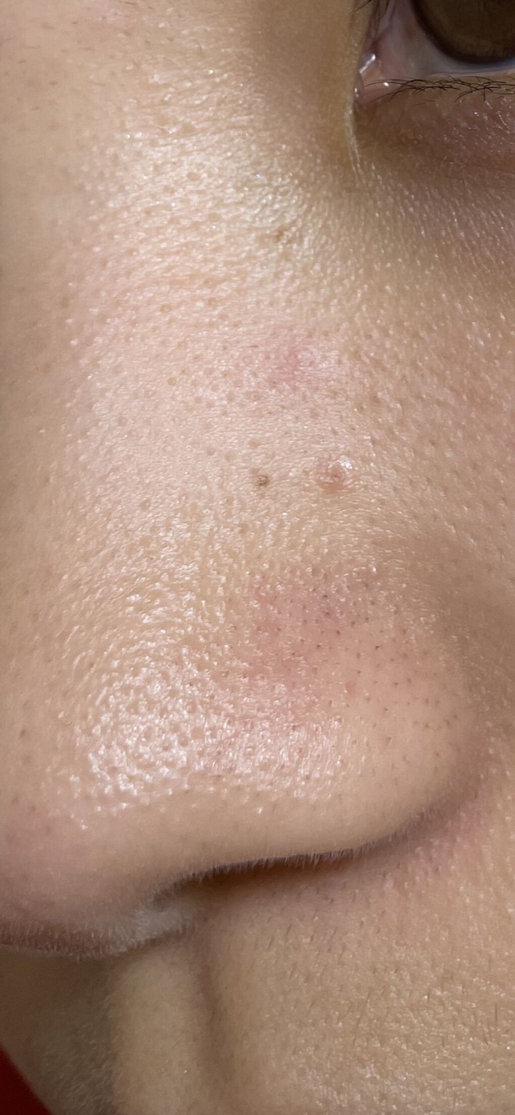 ハトムギ保湿ジェル(ナチュリエ スキンコンディショニングジェル)/ナチュリエ/美容液を使ったクチコミ（2枚目）