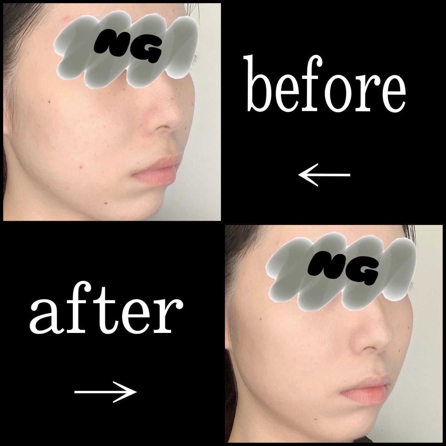 ディオールスキン フォーエヴァー フルイド グロウ/Dior/リキッドファンデーションを使ったクチコミ(3枚目)