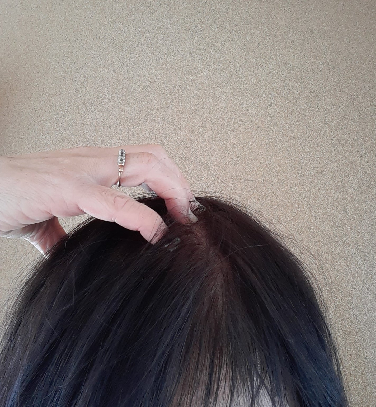 スカルプリッチ プロフェッショナル/日清食品/頭皮ローションを使ったクチコミ(6枚目)