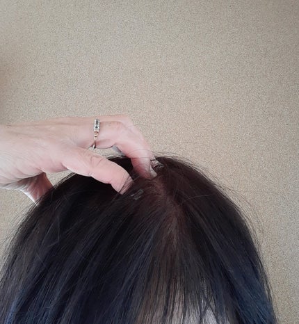 スカルプリッチ プロフェッショナル/日清食品/頭皮ローションを使ったクチコミ(6枚目)