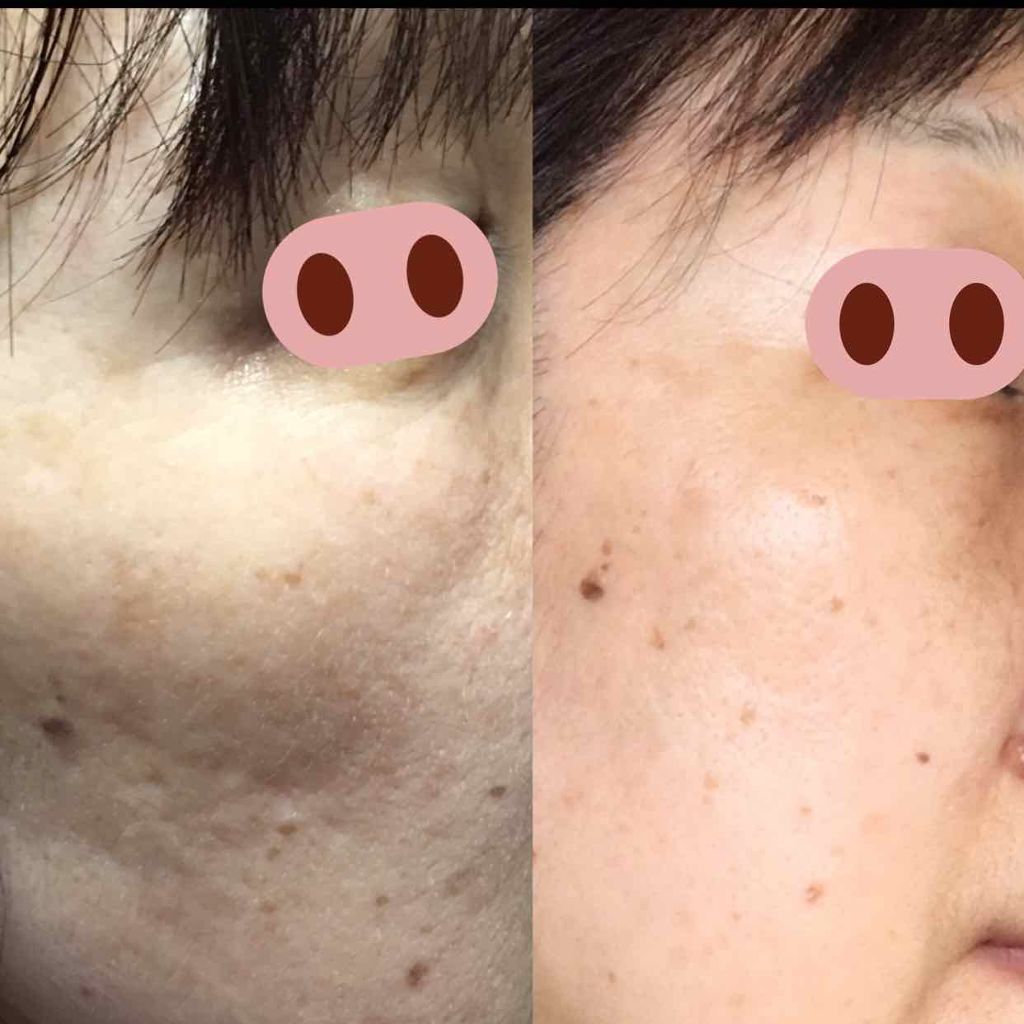 グリーンタンジェリン ビタC ダークスポットケアセラム/goodal/美容液を使ったクチコミ(2枚目)