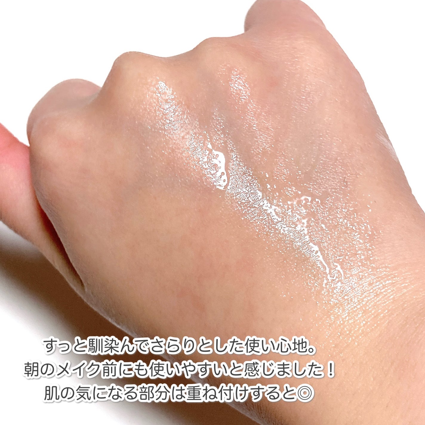 エンリッチCセラム/IGA LAB/美容液を使ったクチコミ(5枚目)