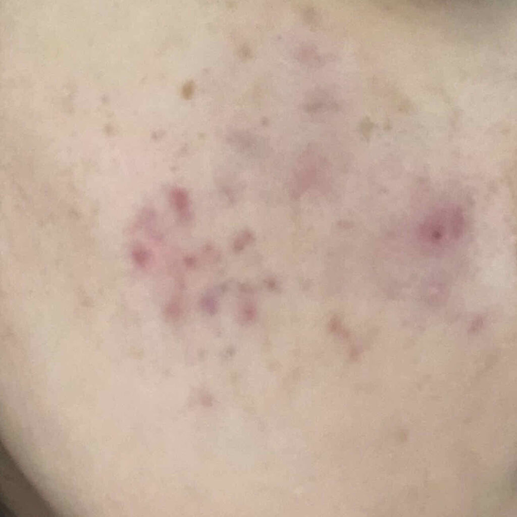 ヴァセリン アドバンスドリペア ボディローション 無香料/ヴァセリン/ボディローションを使ったクチコミ（3枚目）