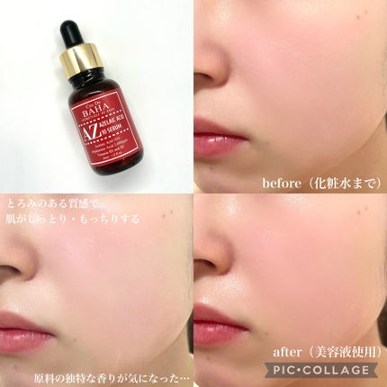 AZアゼライン酸10セラム/コスデバハ/美容液を使ったクチコミ(4枚目)