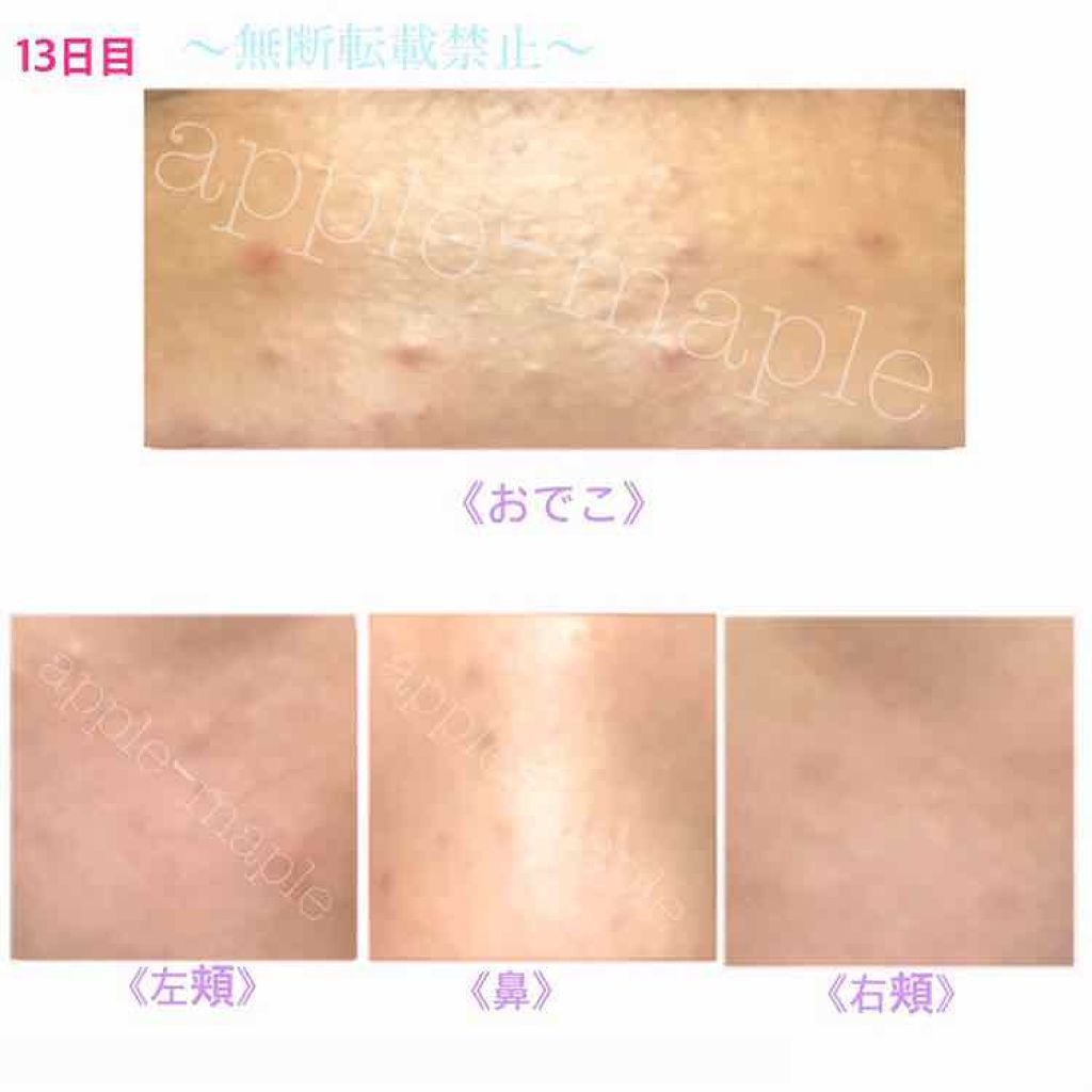 ロゼット 洗顔パスタ 荒性肌/ロゼット/洗顔フォームを使ったクチコミ(4枚目)