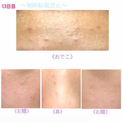 ロゼット 洗顔パスタ 荒性肌/ロゼット/洗顔フォームを使ったクチコミ(4枚目)