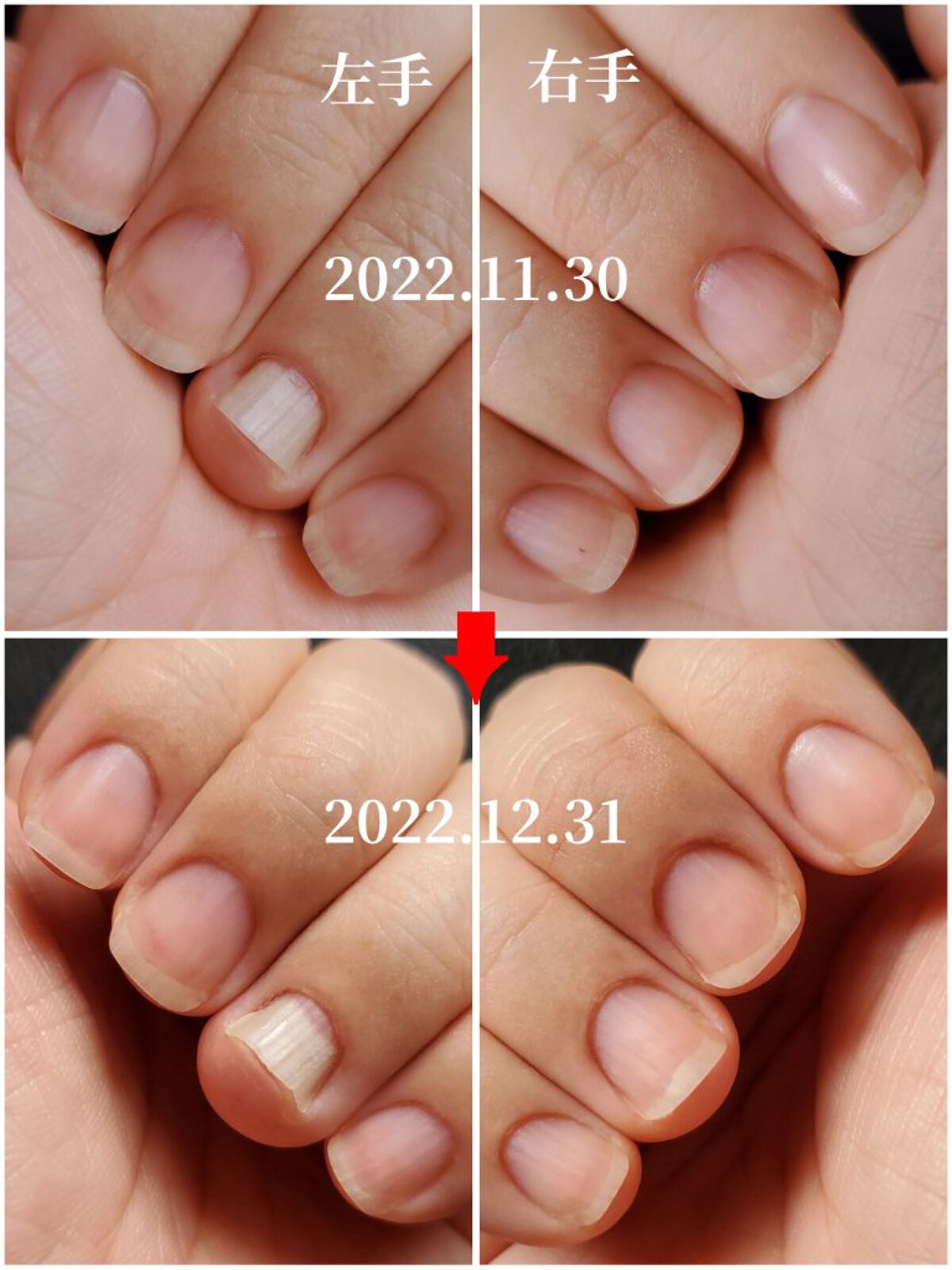 ドロップリペアセラム/ネイルネイル/ネイルオイル・トリートメントを使ったクチコミ（3枚目）