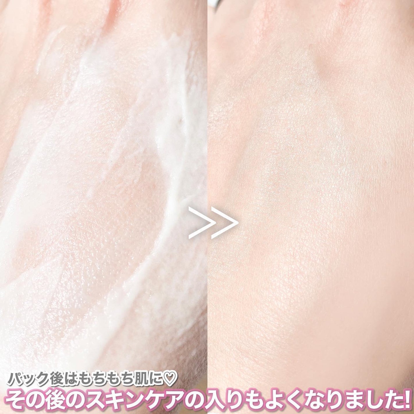 skinmarche WAOPLUS プラントベースミルクブースターマスク/ブレーンコスモス/洗い流すパック・マスクを使ったクチコミ(4枚目)