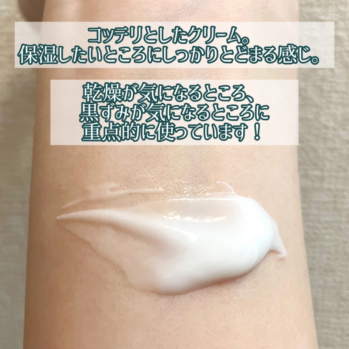 BnDアンダーアームクリーム(ボディクリーム)/BnD/デリケートゾーンケアを使ったクチコミ(3枚目)