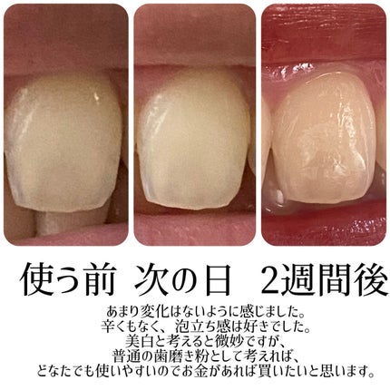 アパガードロイヤル/アパガード/歯磨き粉を使ったクチコミ(3枚目)