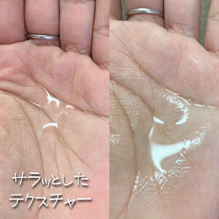 アクネケア ジェル乳液 <医薬部外品>/ファンケル/乳液を使ったクチコミ(4枚目)