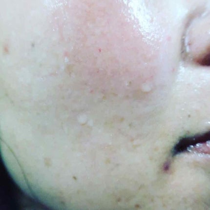 ミスクレオ on LIPS 「素肌レベルを簡単に上げてくれるIN-BE+Vカーボミストが20..」(4枚目)