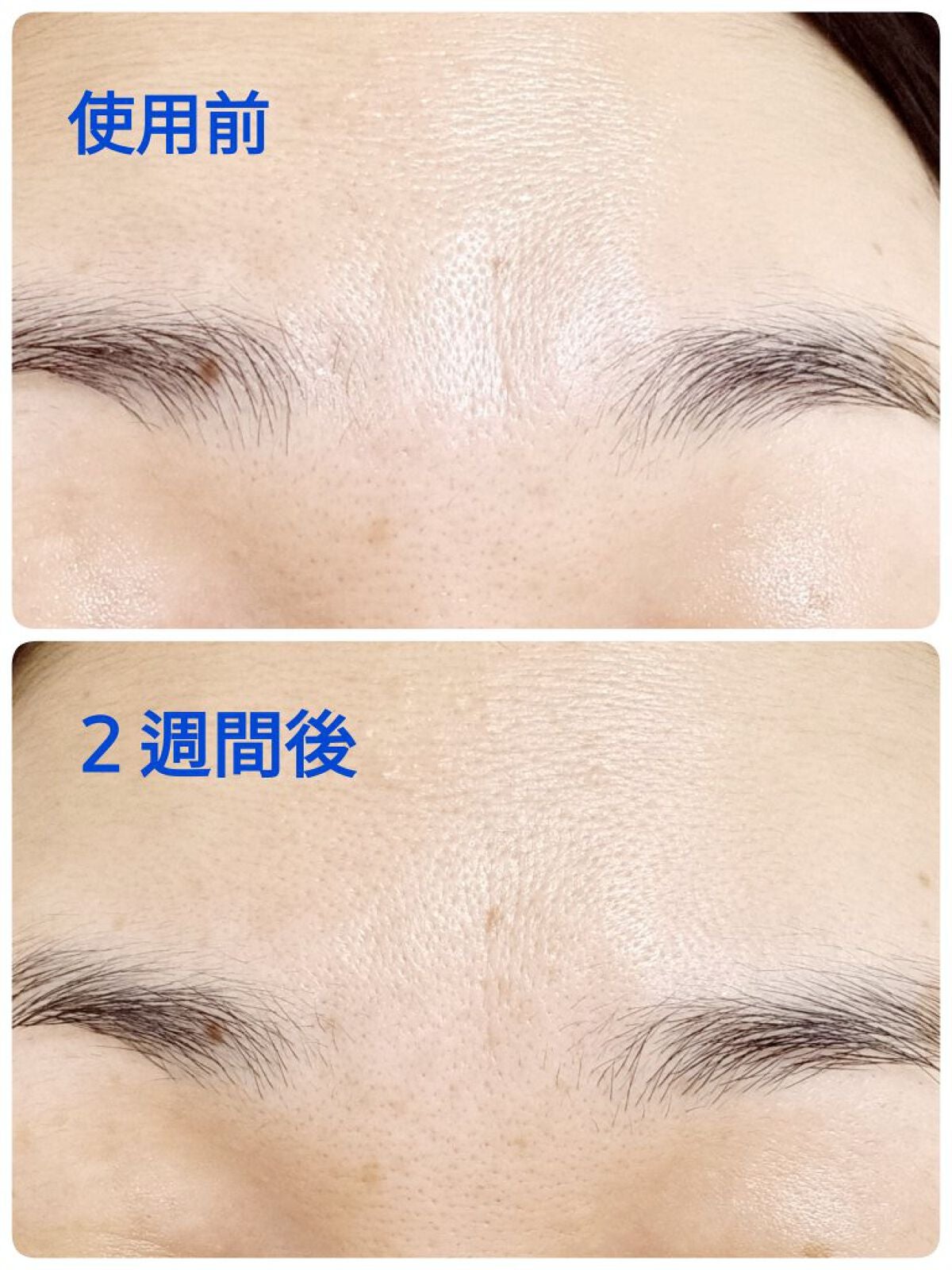 レチノール エキスパート0.1%/IOPE/美容液を使ったクチコミ(2枚目)