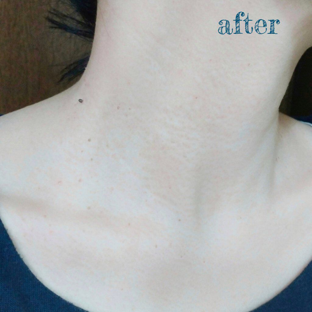 APRIAGEオイルS/AiB(エーアイビー)/ボディクリームを使ったクチコミ(8枚目)