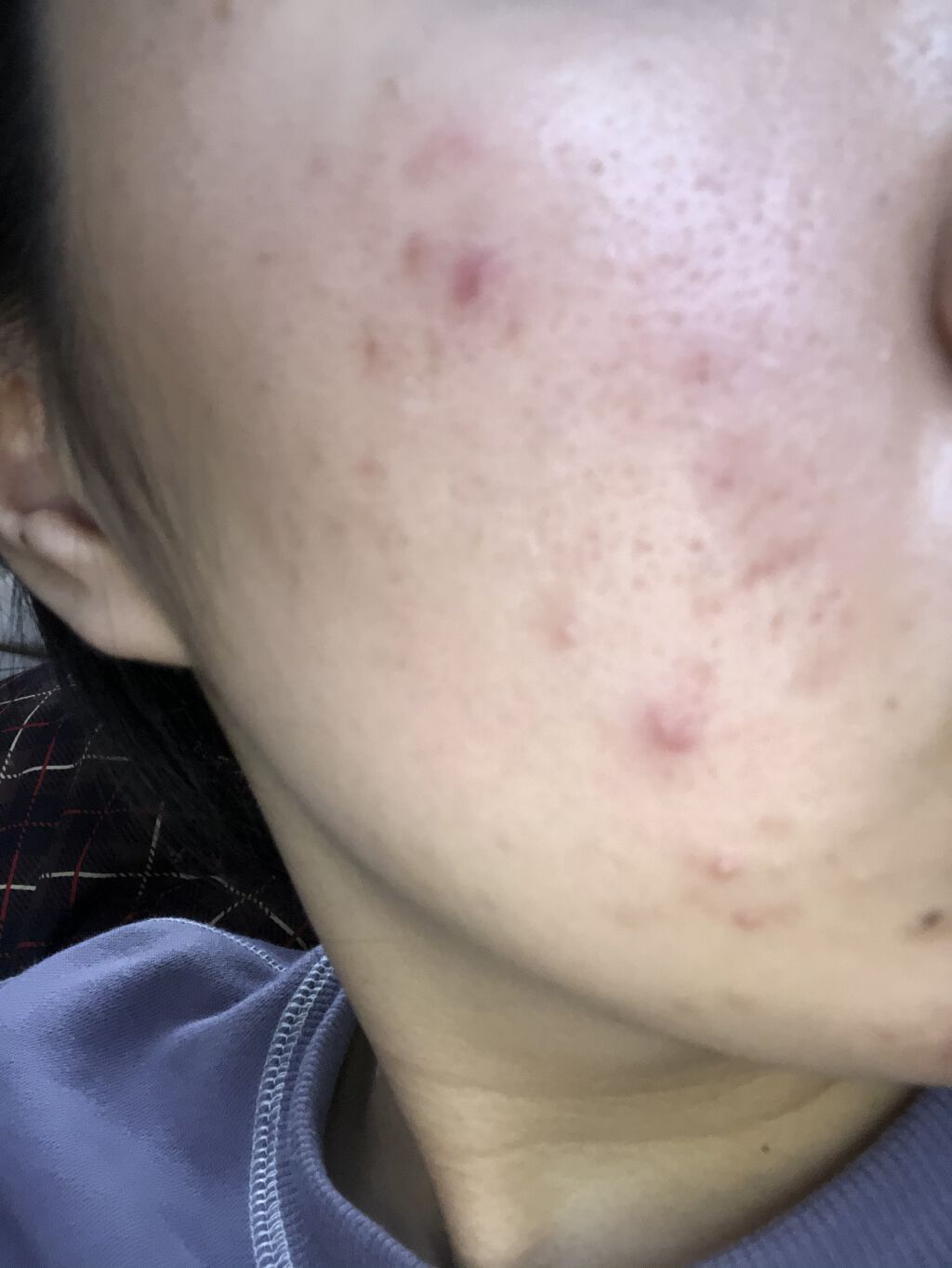 ホワイト洗顔クリーム/雪肌粋/洗顔フォームを使ったクチコミ（1枚目）