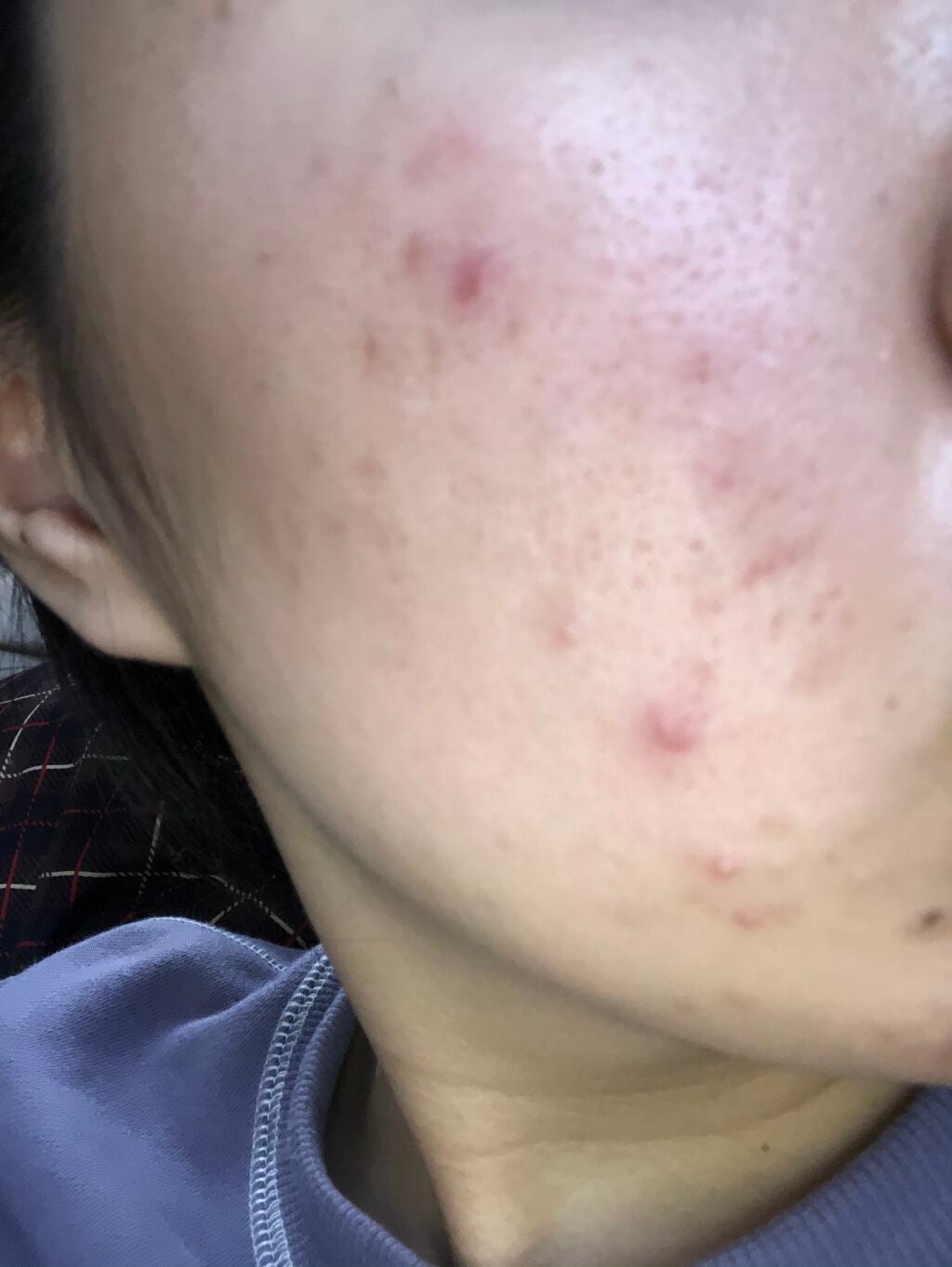 ホワイト洗顔クリーム/雪肌粋/洗顔フォームを使ったクチコミ(1枚目)