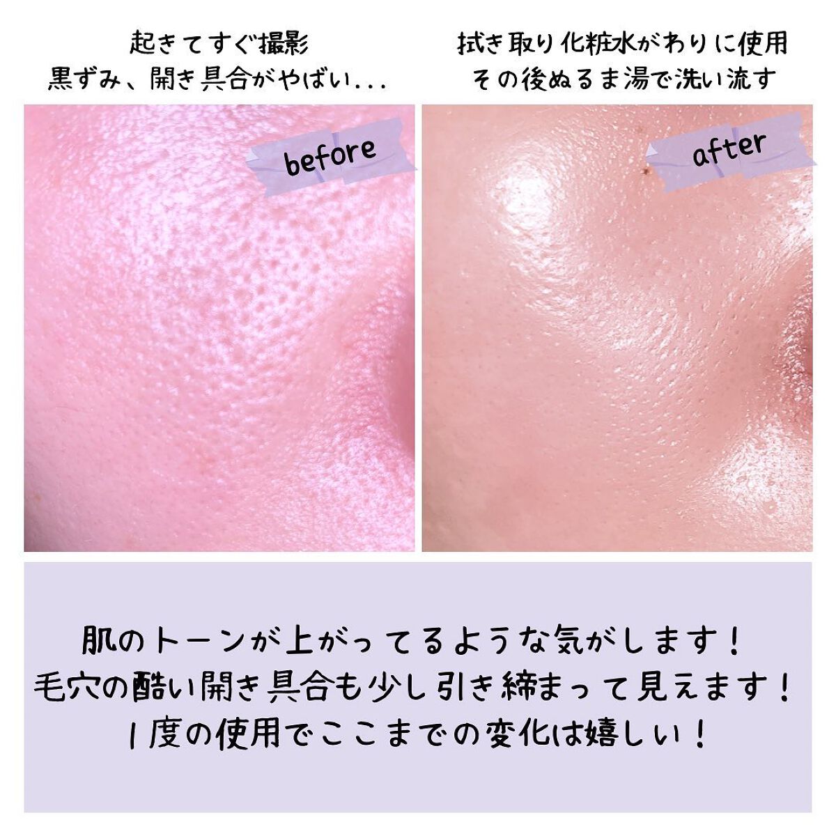 アイムユアヒーロー/SISI/クレンジングウォーターを使ったクチコミ（3枚目）