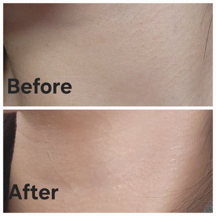 レチノール スーパーバウンス セラム/IOPE/美容液を使ったクチコミ(4枚目)