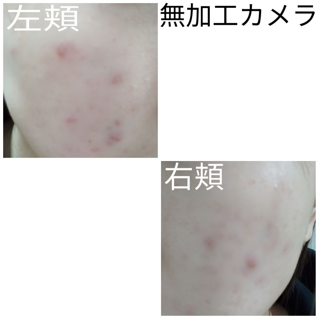 パワーマスク SP/ラッシュ/スクラブ・ゴマージュを使ったクチコミ（2枚目）