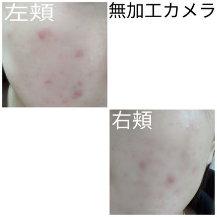 ティーツリーウォーター/ラッシュ/ミスト状化粧水を使ったクチコミ(2枚目)