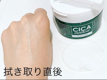 CICA method TONER PAD/コジット/化粧水を使ったクチコミ（6枚目）