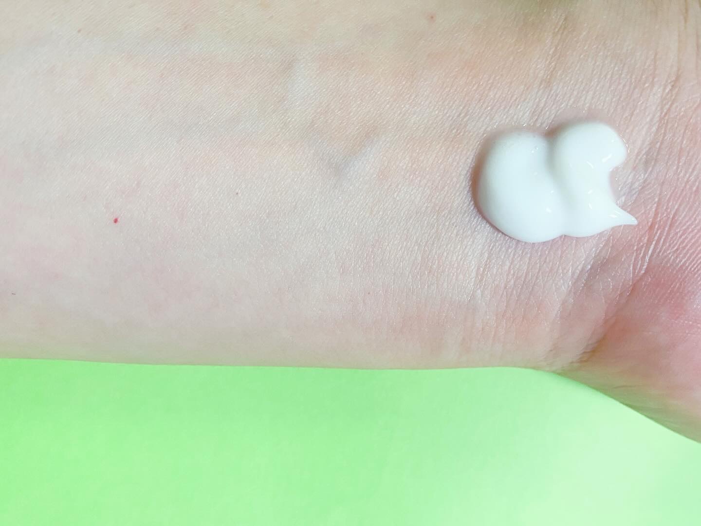 フレッシュモイスチャーボディローション/Derma:B/ボディローションを使ったクチコミ（3枚目）