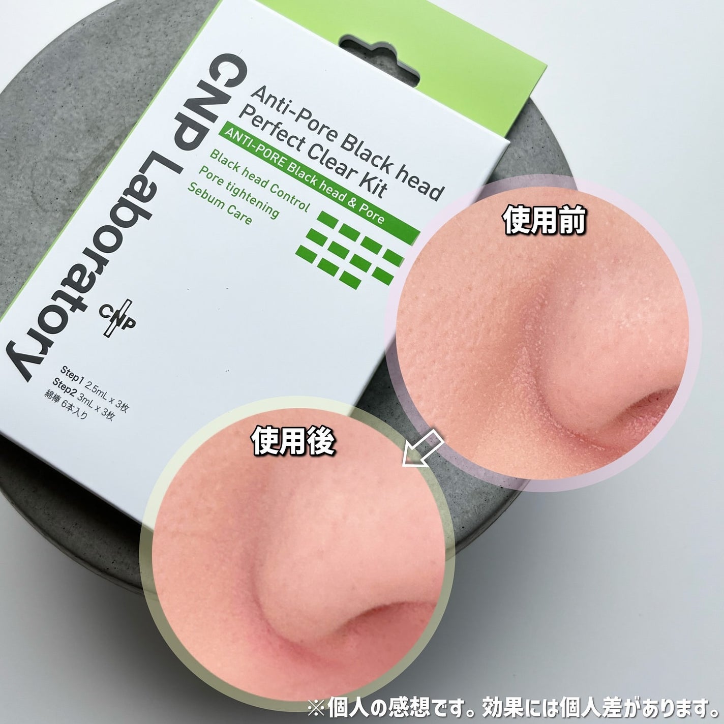 ★うまうまさん★フォロバ100 on LIPS 「˗ˏˋ毛穴汚れもツルツル鼻肌にˎˊ˗CNP「ブラックヘッド..」(3枚目)