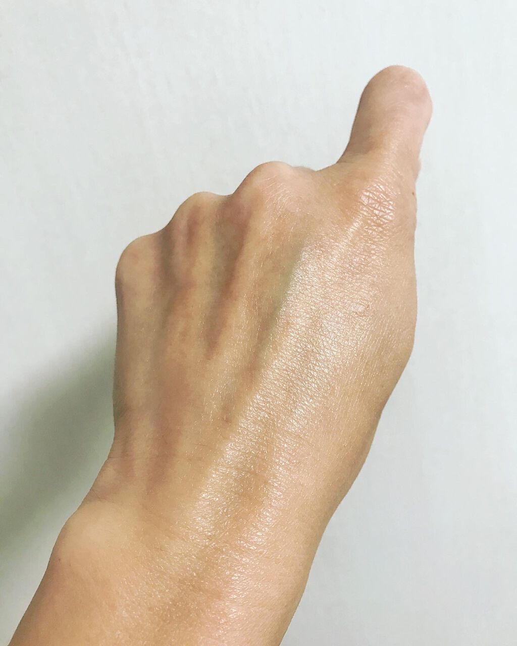 ケシミン クリームj/ケシミン/その他スキンケアを使ったクチコミ（3枚目）