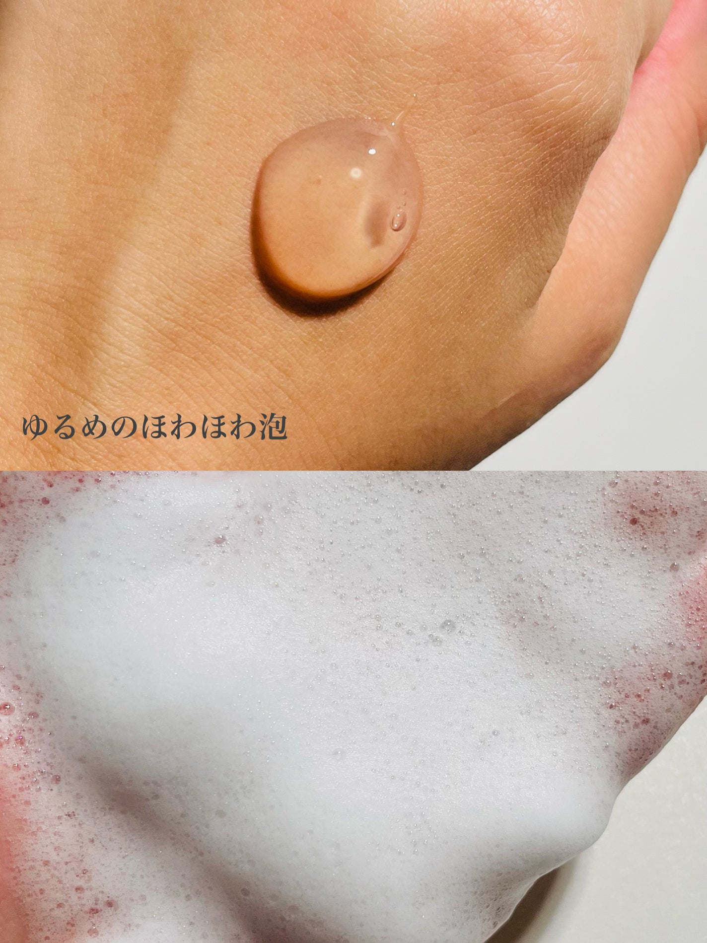 ピンクティーツリージェルクレンザー/APLIN/その他洗顔料を使ったクチコミ(5枚目)