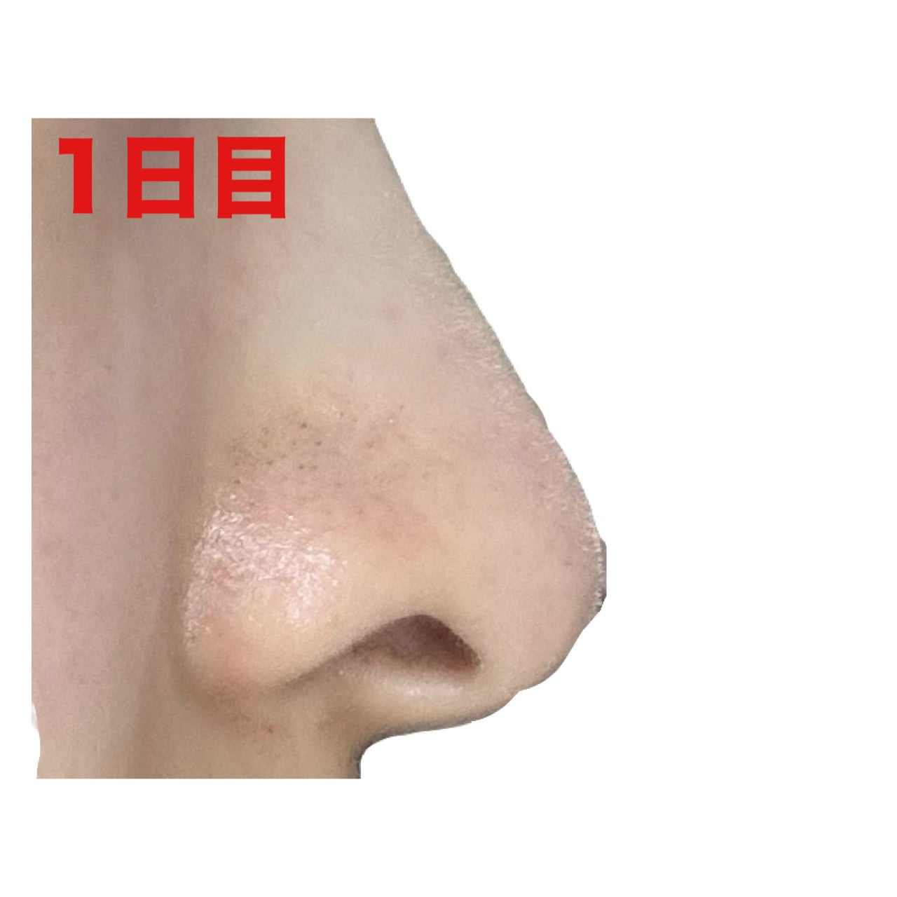 薬用 しみ 集中対策 美容液/メラノCC/美容液を使ったクチコミ(4枚目)