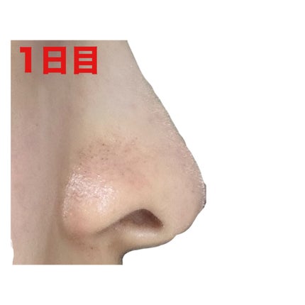 薬用 しみ 集中対策 美容液/メラノCC/美容液を使ったクチコミ(4枚目)