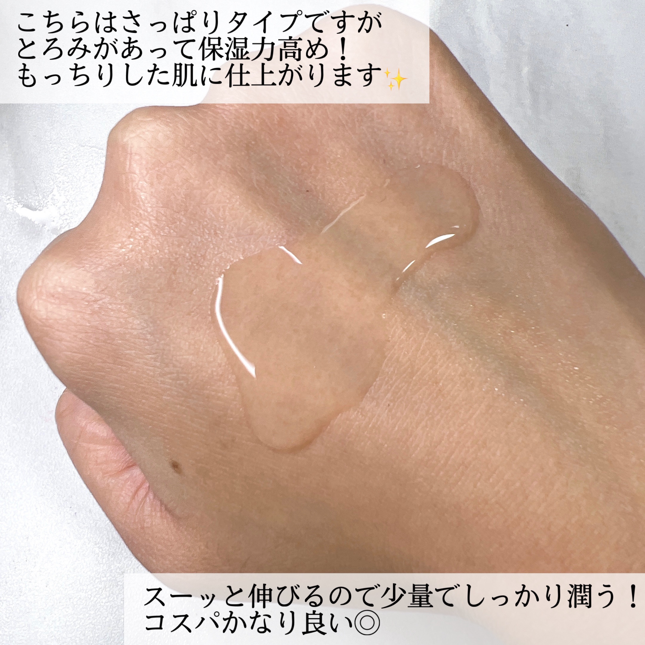 ダーマレーザー スーパーVC100ローション（さっぱり）/クオリティファースト/化粧水を使ったクチコミ（3枚目）