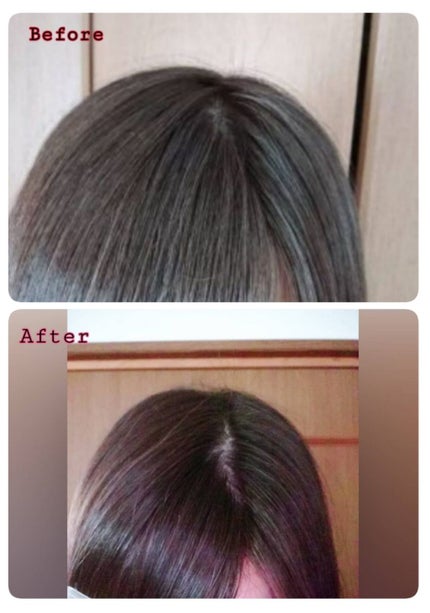 すこやか地肌 頭皮美容液/MEJ/頭皮ローションを使ったクチコミ(4枚目)