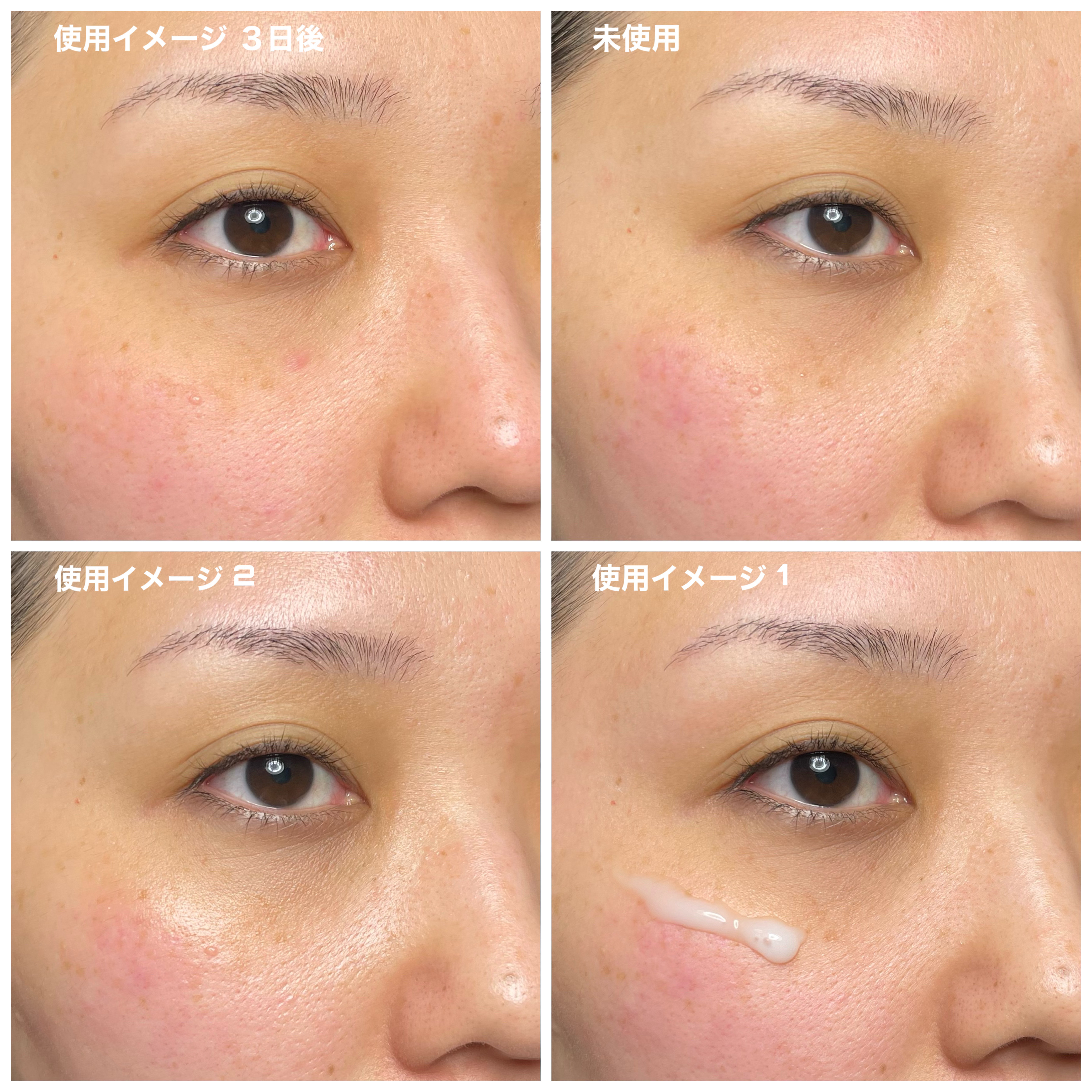 VT リードルショット 美容液 300 50ml×3 リードルショット300｜VTの効果に関する口コミ - 〖VTリードルショット