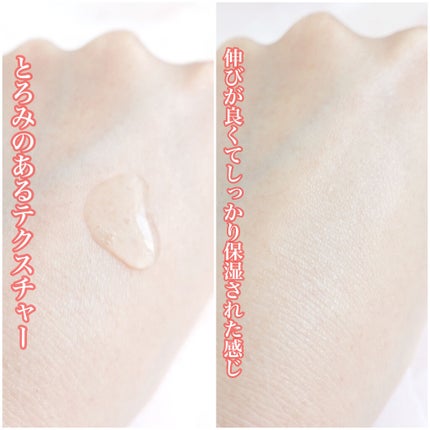 美白美容液 W/ちふれ/美容液を使ったクチコミ(3枚目)