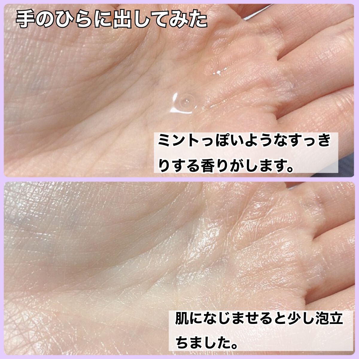 アクレオンセボエクストラクター/ANACIS/その他スキンケアを使ったクチコミ(5枚目)