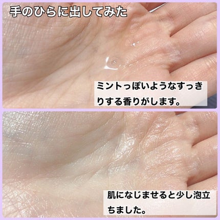 アクレオンセボエクストラクター/ANACIS/その他スキンケアを使ったクチコミ(5枚目)