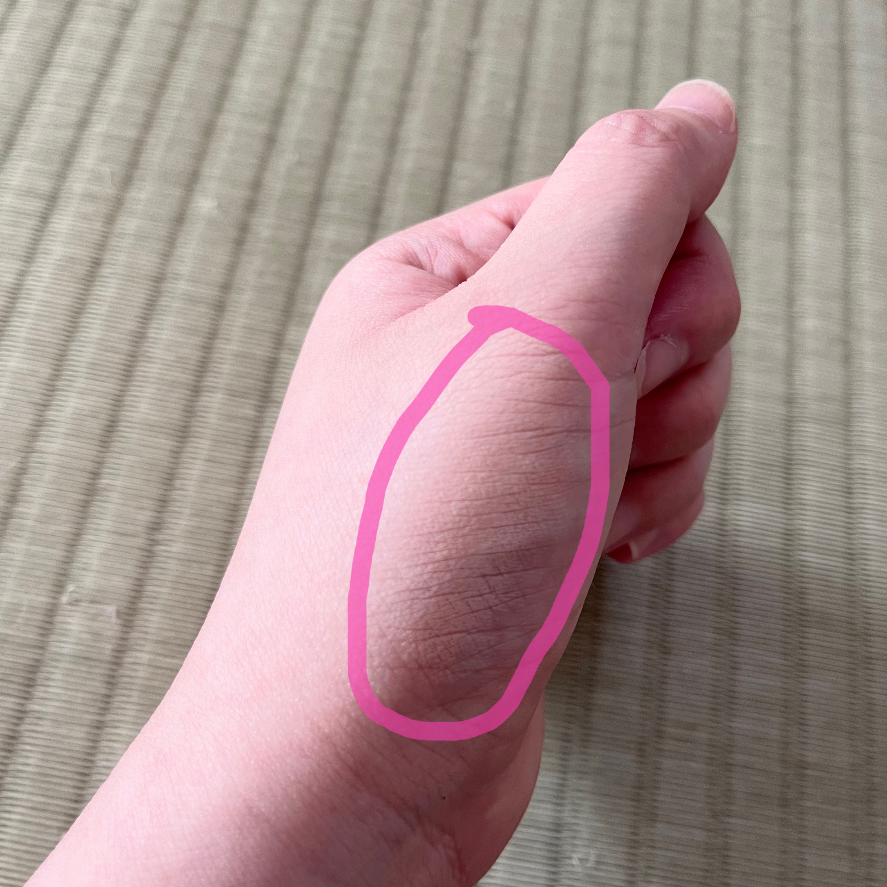 アディクション スキンリフレクト フィックス コンシーラー 001 Porcelain Pink/ADDICTION/リキッドコンシーラーを使ったクチコミ（2枚目）