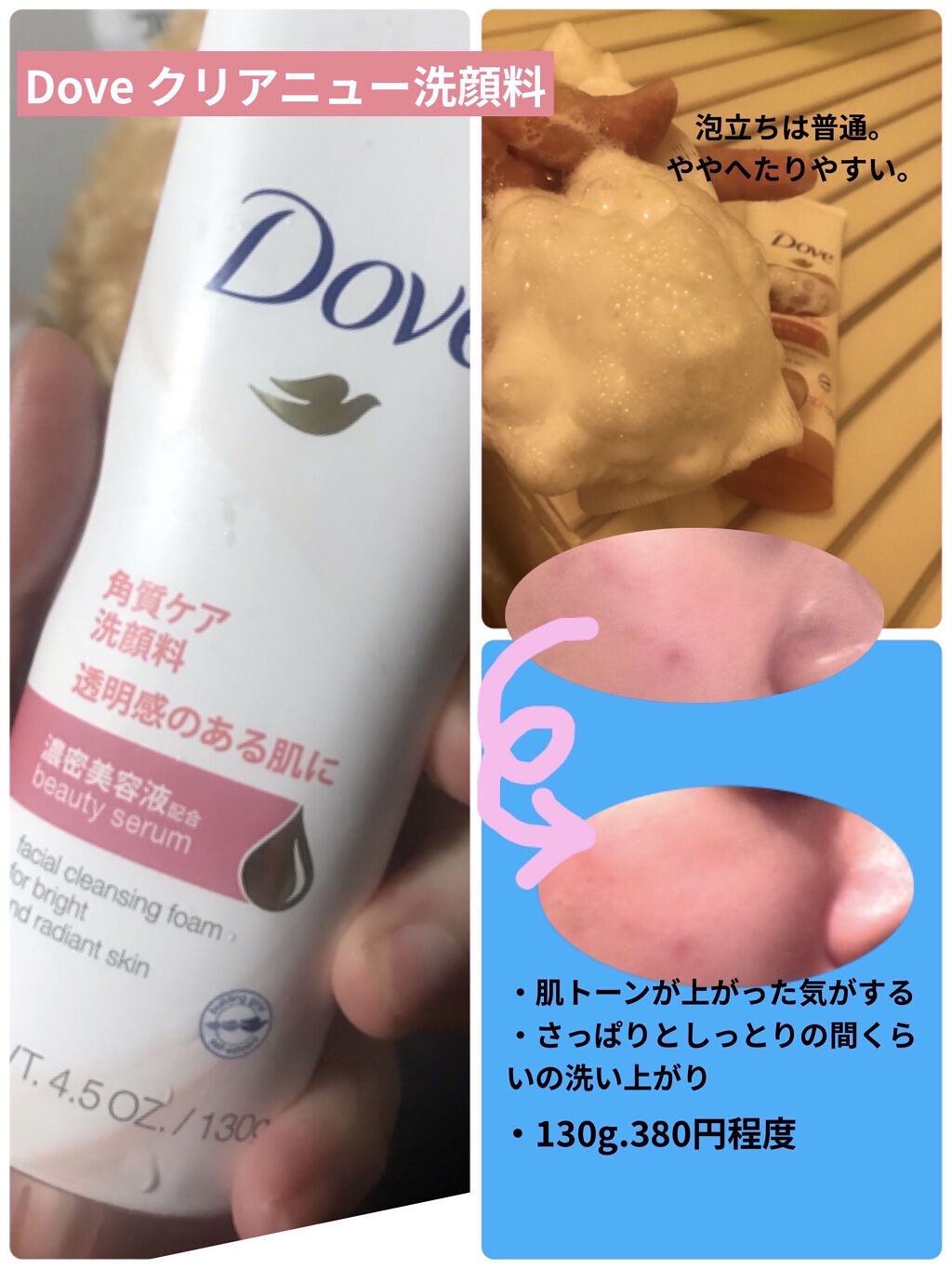 DETクリア ブライト＆ピール ピーリングジェリー <ミックスベリーの香り>/Detclear/ピーリングを使ったクチコミ（2枚目）