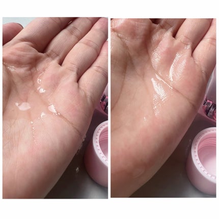 ピンクティーツリートナー/APLIN/化粧水を使ったクチコミ(4枚目)