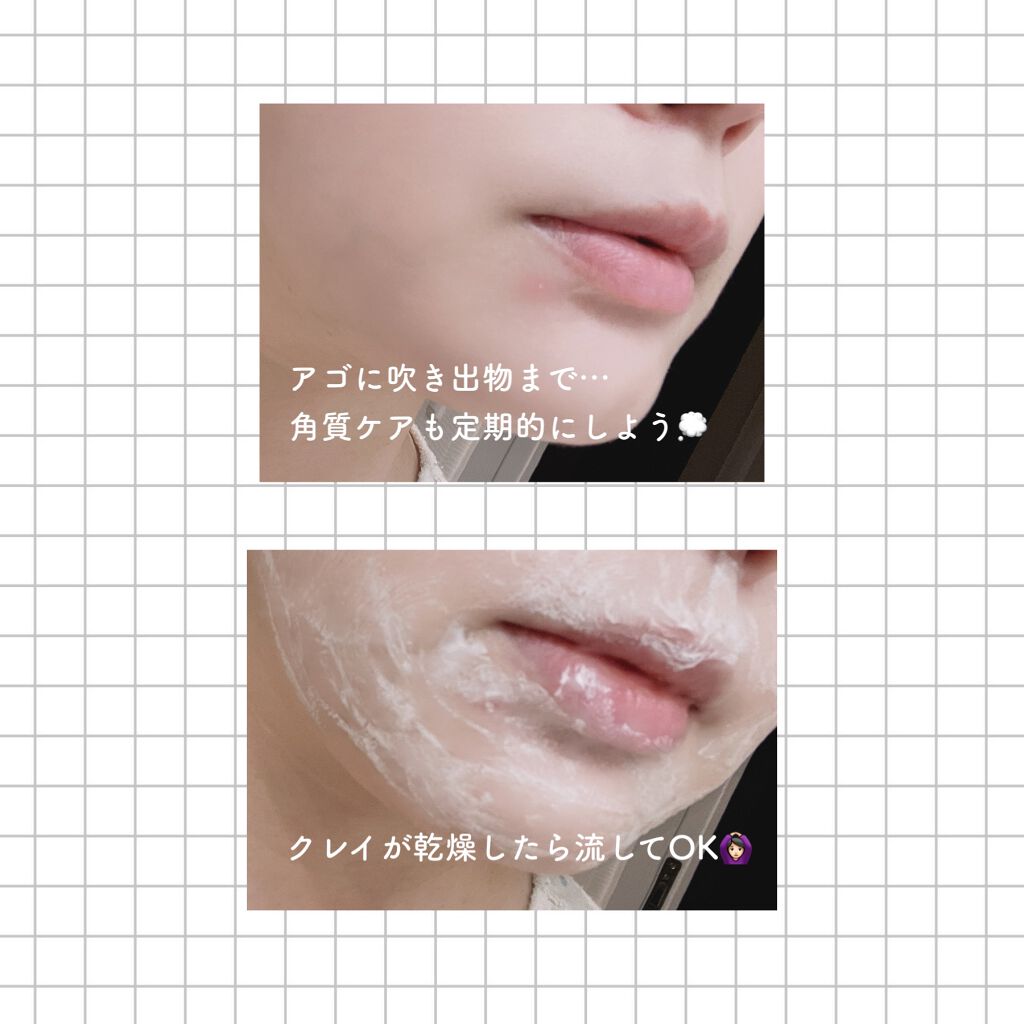 SKIN MUD PURE MASK/DAMDAM/洗い流すパック・マスクを使ったクチコミ（3枚目）