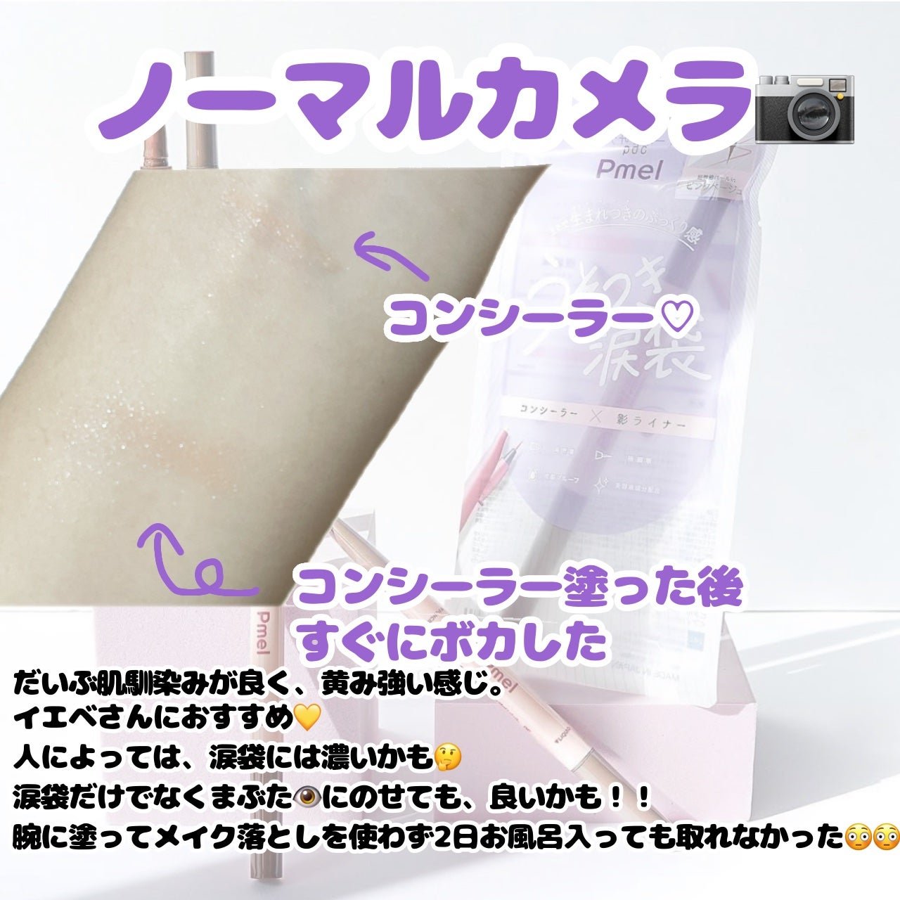 ãã¡ã«ãããŒãã§ã¯ãã¢ã€ããã°ãã³ã·ã«/pdc/ãªãããã¢ã€ã©ã€ããŒã䜿ã£ãã¯ãã³ãïŒ4æç®ïŒ