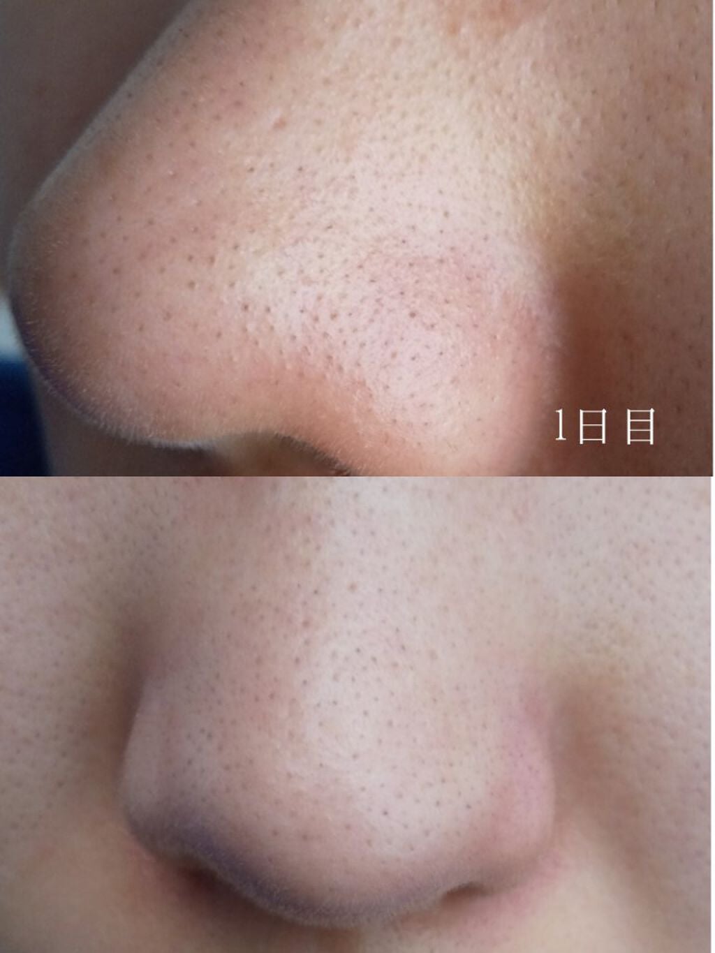 スキンクリア クレンズ オイル アロマタイプ/アテニア/オイルクレンジングを使ったクチコミ(3枚目)