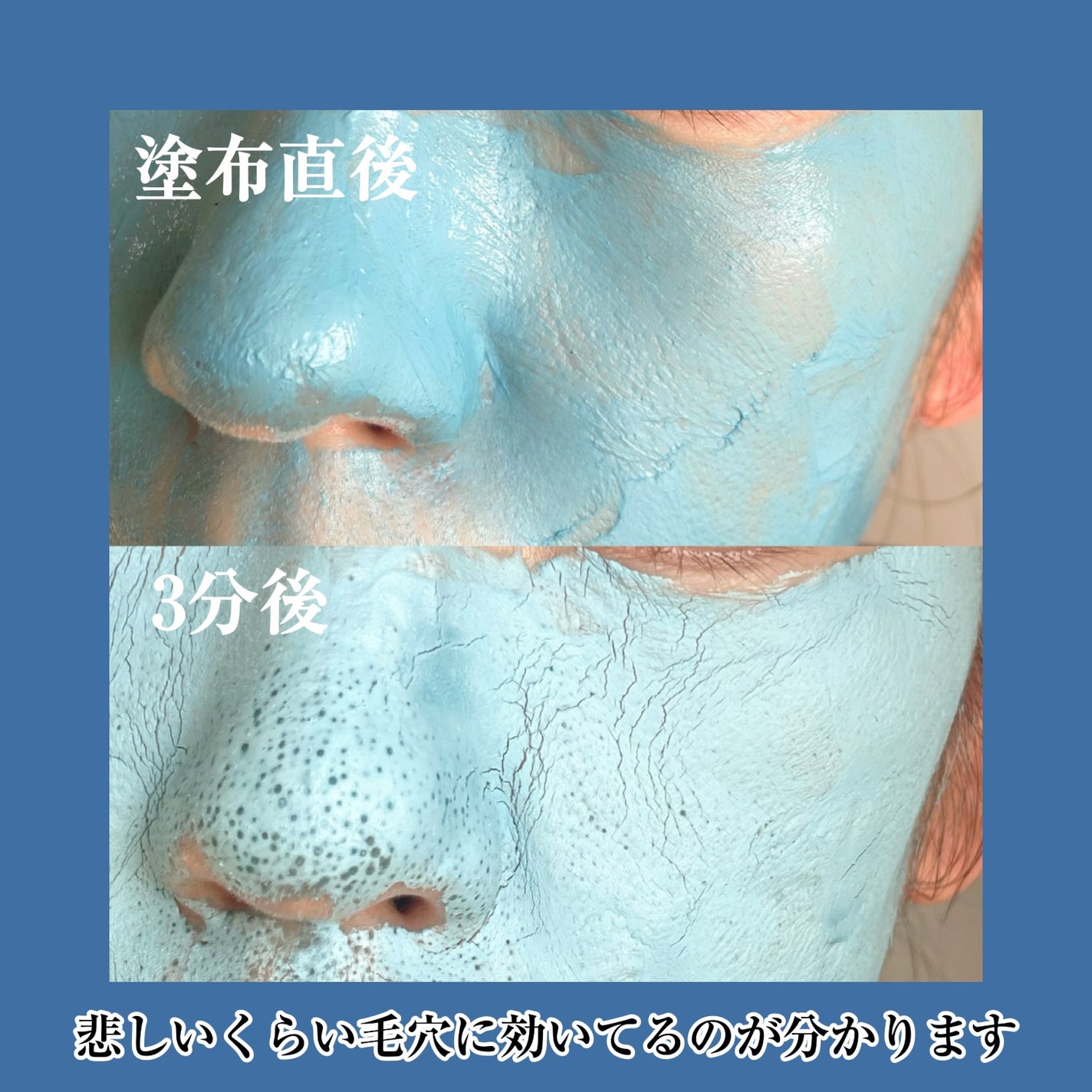 ゼロ毛穴クレイパック/MEDICUBE/洗い流すパック・マスクを使ったクチコミ(3枚目)