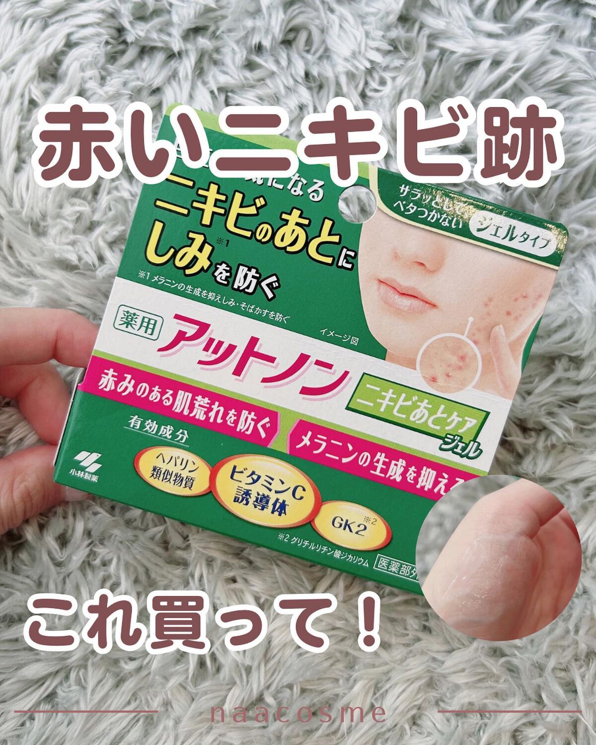 ニキビあとケアジェル/アットノン/その他スキンケアを使ったクチコミ(1枚目)