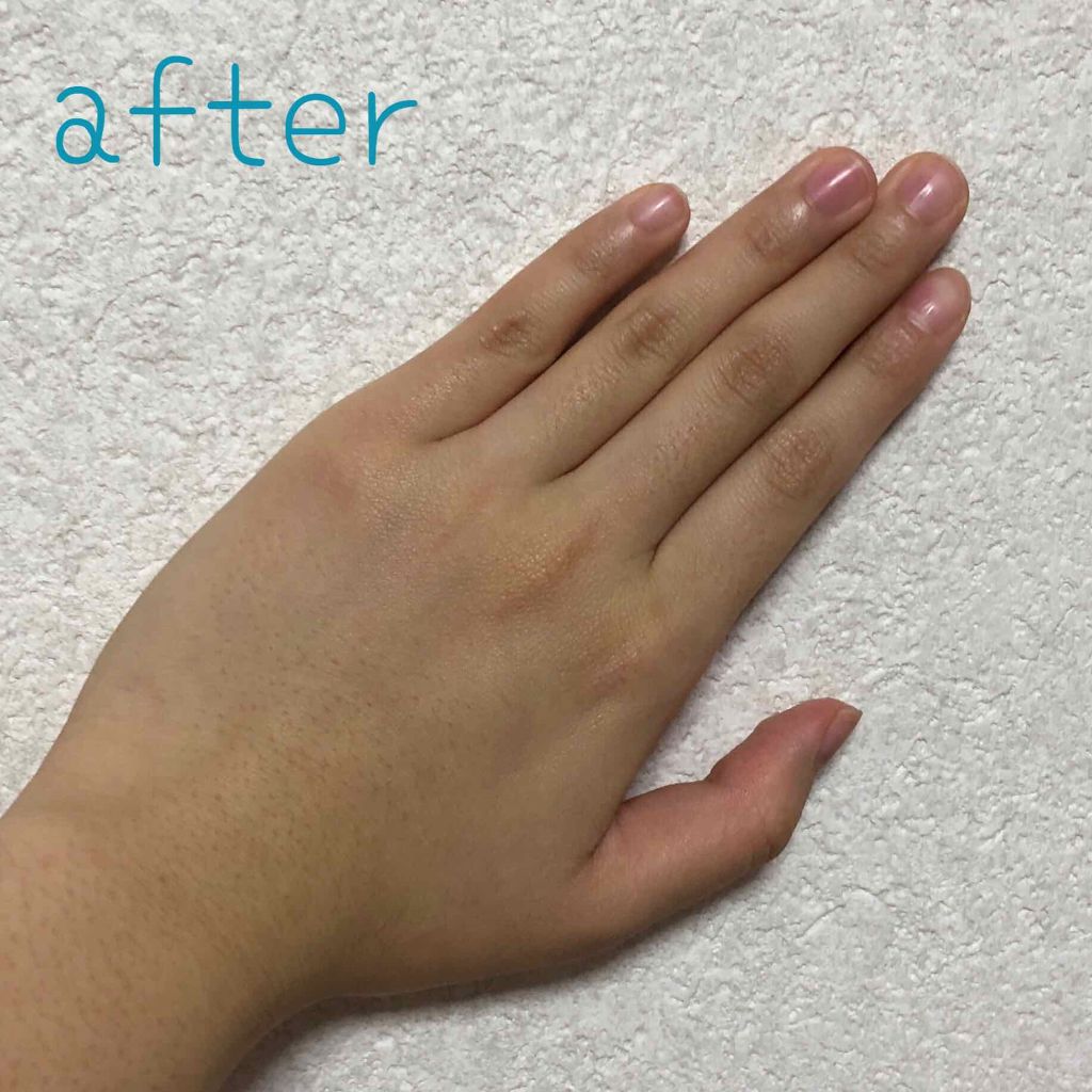 エバレッシュホワイトEX(医薬品)/エバレッシュ/その他を使ったクチコミ(3枚目)