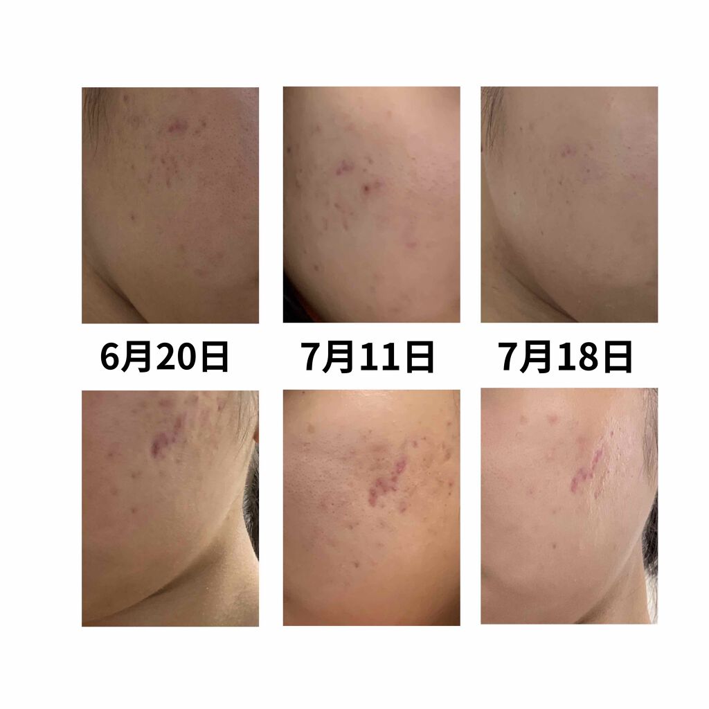 潤い化粧水/ももぷり/化粧水を使ったクチコミ(3枚目)