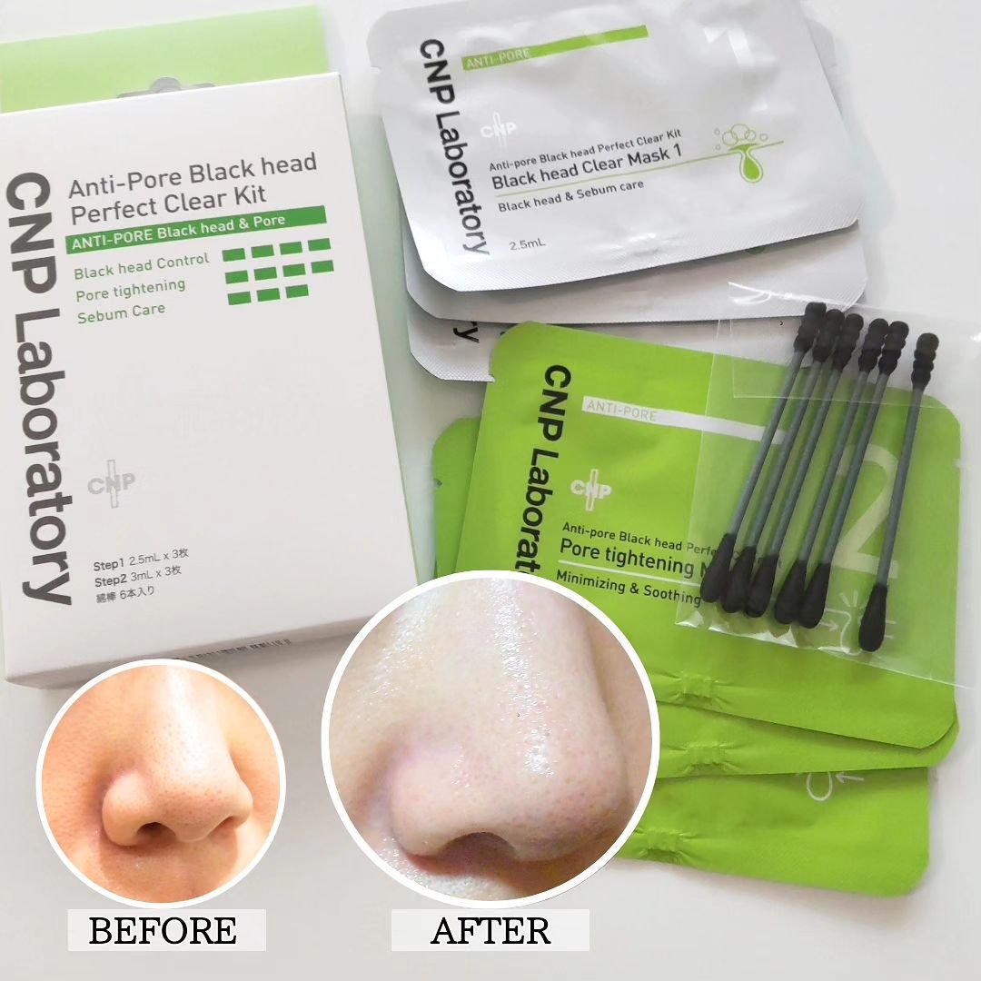 アンチポアブラックヘッドパーフェクトクリアキット/CNP Laboratory/シートマスク・パックを使ったクチコミ（2枚目）