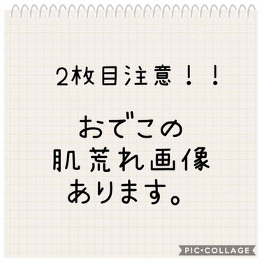 Ⅲ トライアルセット/NOV/トライアルキットを使ったクチコミ（1枚目）