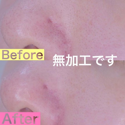 トリプルアシッドクレイパック/APRILSKIN/洗い流すパック・マスクを使ったクチコミ(5枚目)